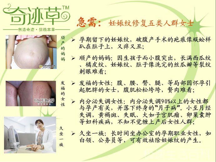 肥胖纹怎么去掉_去除肥胖纹的方法(图3)