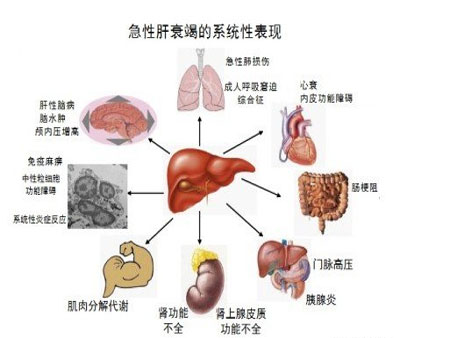 肝不好会有哪些症状(图3)