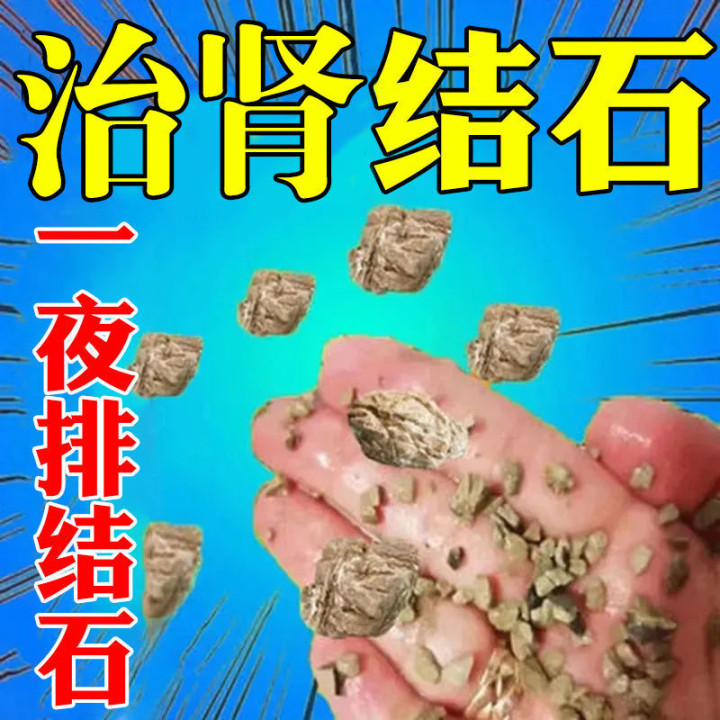 排肾结石的药哪样最好(图3)