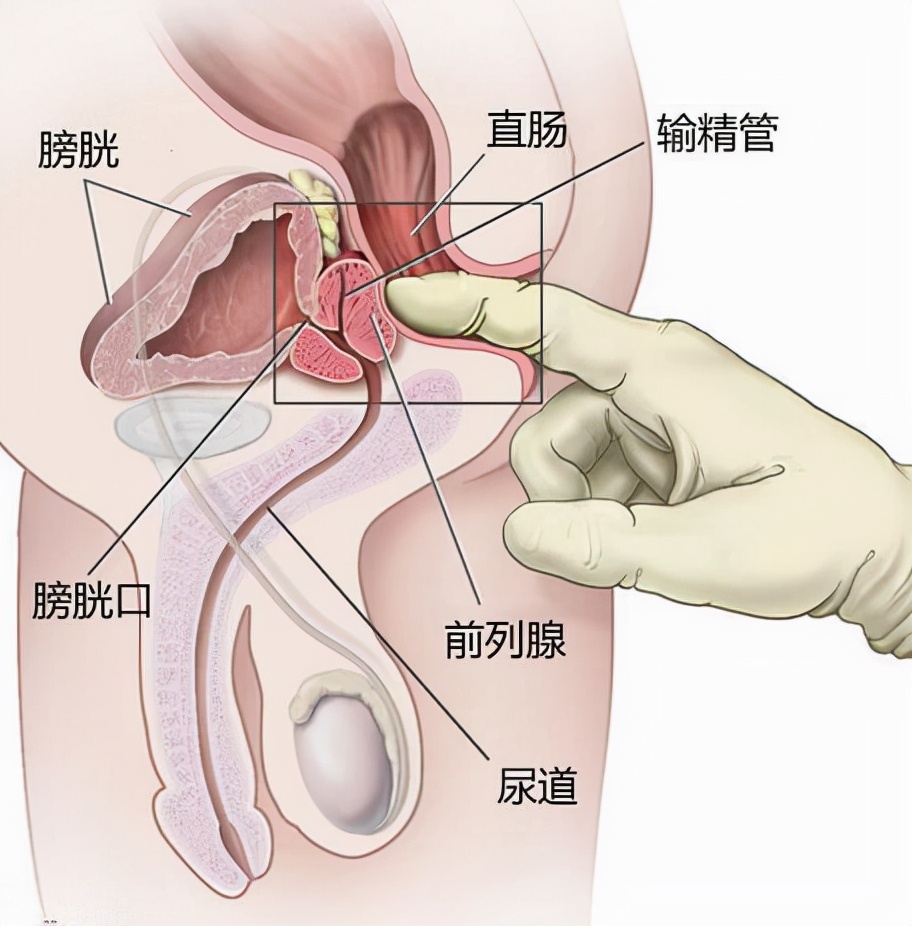 老公前列腺炎能备孕吗(图3)