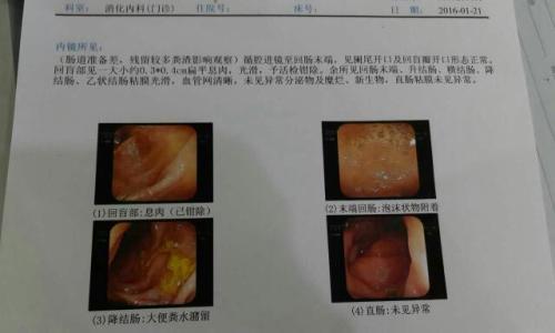 大便拉出血和肠炎有关系吗(图1)