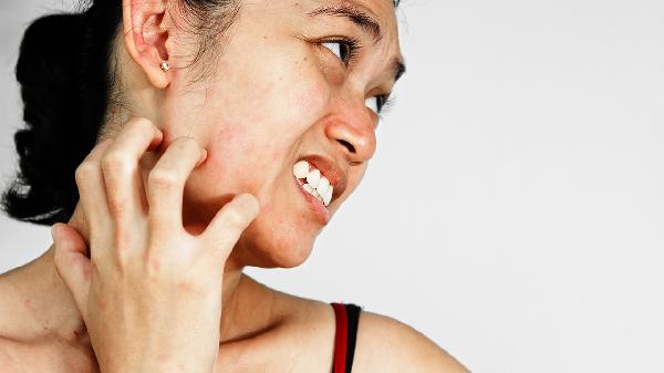 如何去除脖子上的斑点(图1) 如何去除脖子上的斑点(图1)