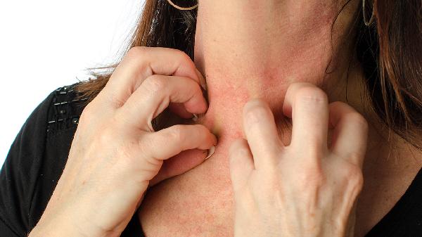 如何去除脖子上的斑点(图2) 如何去除脖子上的斑点(图2)