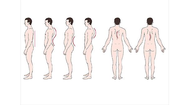 强直脊柱炎腿疼怎么治疗(图2)