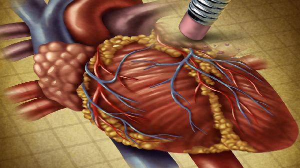 心脏素高会引起心脏骤停吗？(图1)