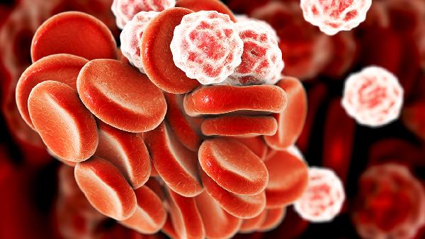 长期粒细胞高引起白细胞高(图1)