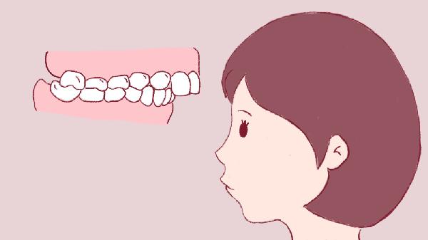 牙齿很正常可是地包天(图1)