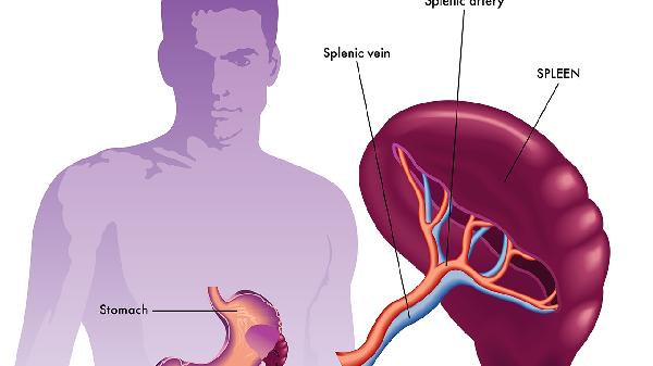 脾大脾功能亢进是什么引起的(图2)