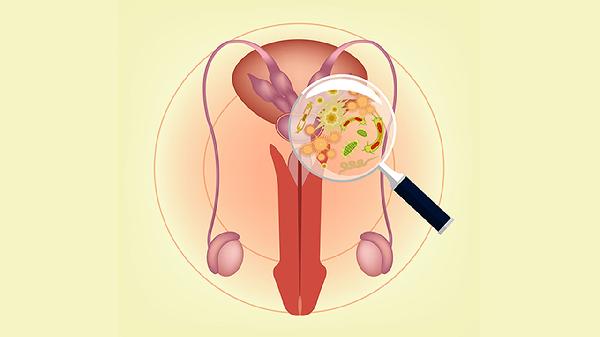 宫颈肥大白肉是囊肿(图1)