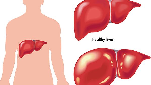 宝宝肝受损怎么办(图2)