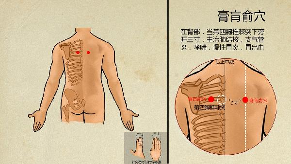 梨状肌综合征的最佳治疗方法穴位(图1)