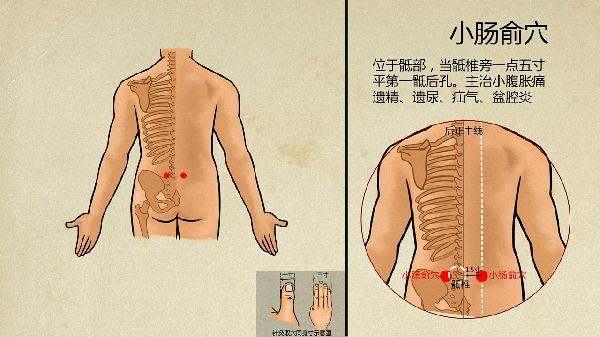 梨状肌综合征的最佳治疗方法穴位(图2)