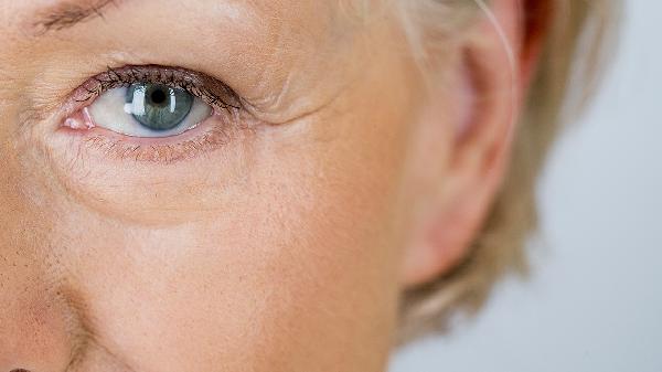 做去鱼尾纹失败修复怎么样?好吗?(图2) 做去鱼尾纹失败修复怎么样?好吗?(图2)