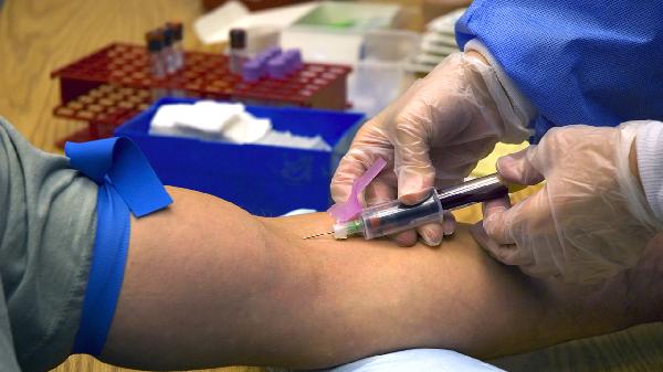 抽血检查可以查幽门螺旋杆菌吗(图2)