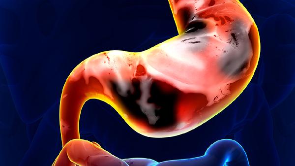 肿瘤化疗患者护理要点有哪些(图1) 肿瘤化疗患者护理要点有哪些(图1)