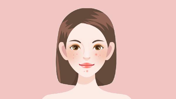 做果酸焕肤祛痘印有哪些禁忌人群(图2)