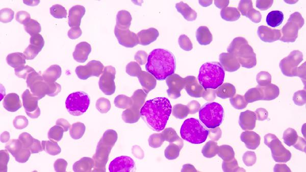 淋巴细胞百分比高是怎么回事(图3)