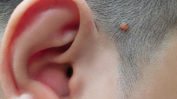 全身皮肤干燥涂什么保湿效果好(图3) 全身皮肤干燥涂什么保湿效果好(图3)