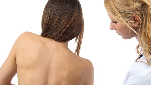 红斑狼疮是什么原因引起的(图1) 红斑狼疮是什么原因引起的(图1)