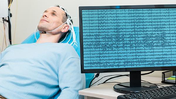 脑供血不足主要是什么原因引起的怎么治疗(图1)