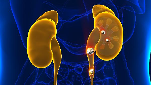 肾积水能吃十种食物和水果吗(图2)