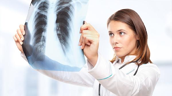 肺结核潜伏期大概多长时间(图3)