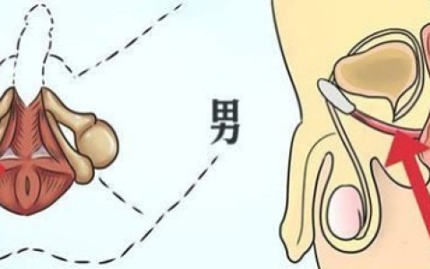 pc肌锻炼真的可以提高性功能