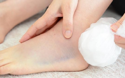 化疗后身体浮肿多久能消失