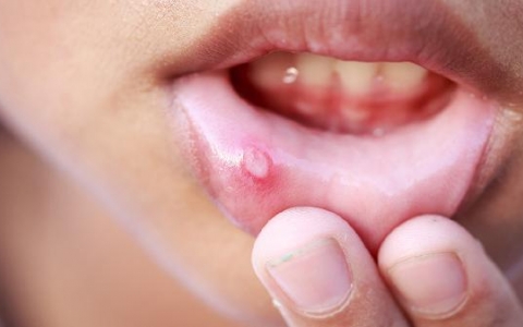 小便完了疼是不是上火引起的