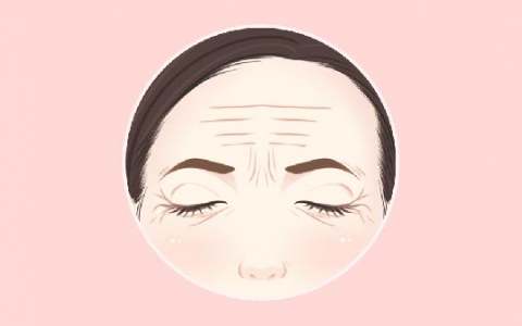 抬头纹怎样才能去除