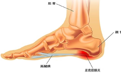 右脚脚心总是在晚上痒是怎么回事