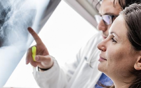 肺结节ct值多少是好的