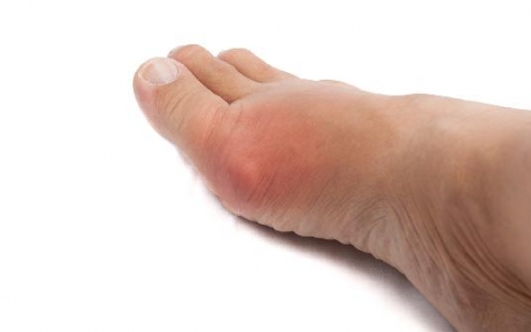 水肿是什么原因引起的