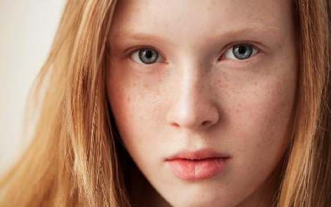 斑块形成需要抗血小板吗