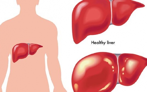 肝出现一点硬化可以恢复吗
