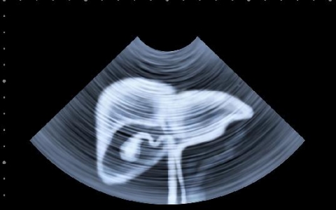 怎样判断是不是肝疼