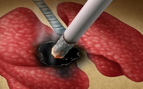 吸烟会引起强直炎复发吗