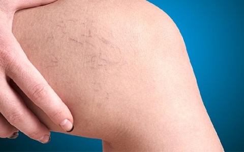 强直关节经常响有危害吗