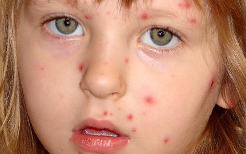 左边脸比右边脸大怎么办