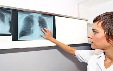 肺结节ct值在哪看到