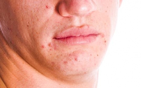 全身过敏不见好怎么办