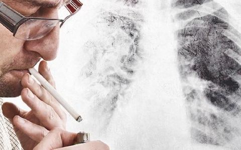 肺结节x光照的出来吗