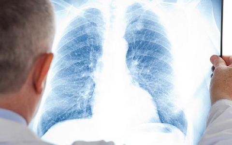 强直病有什么样的危害