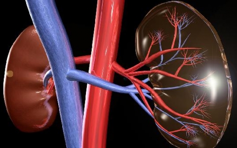 肾结石怎么调理好得快