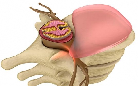 神经性头疼要做什么检查确诊