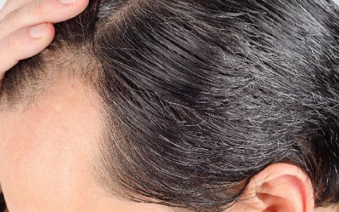 大量脱发吃什么药好的快