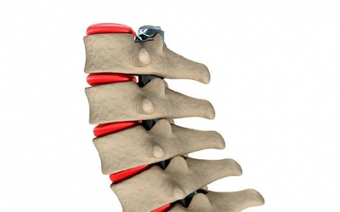 神经性呕吐是什么引起的怎么治疗好