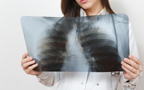 新生儿肺炎细菌性感染