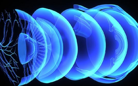 神经性头疼要做什么检查能查出