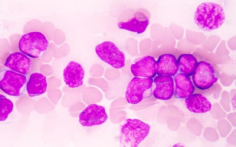 吃什么药降低嗜酸细胞高